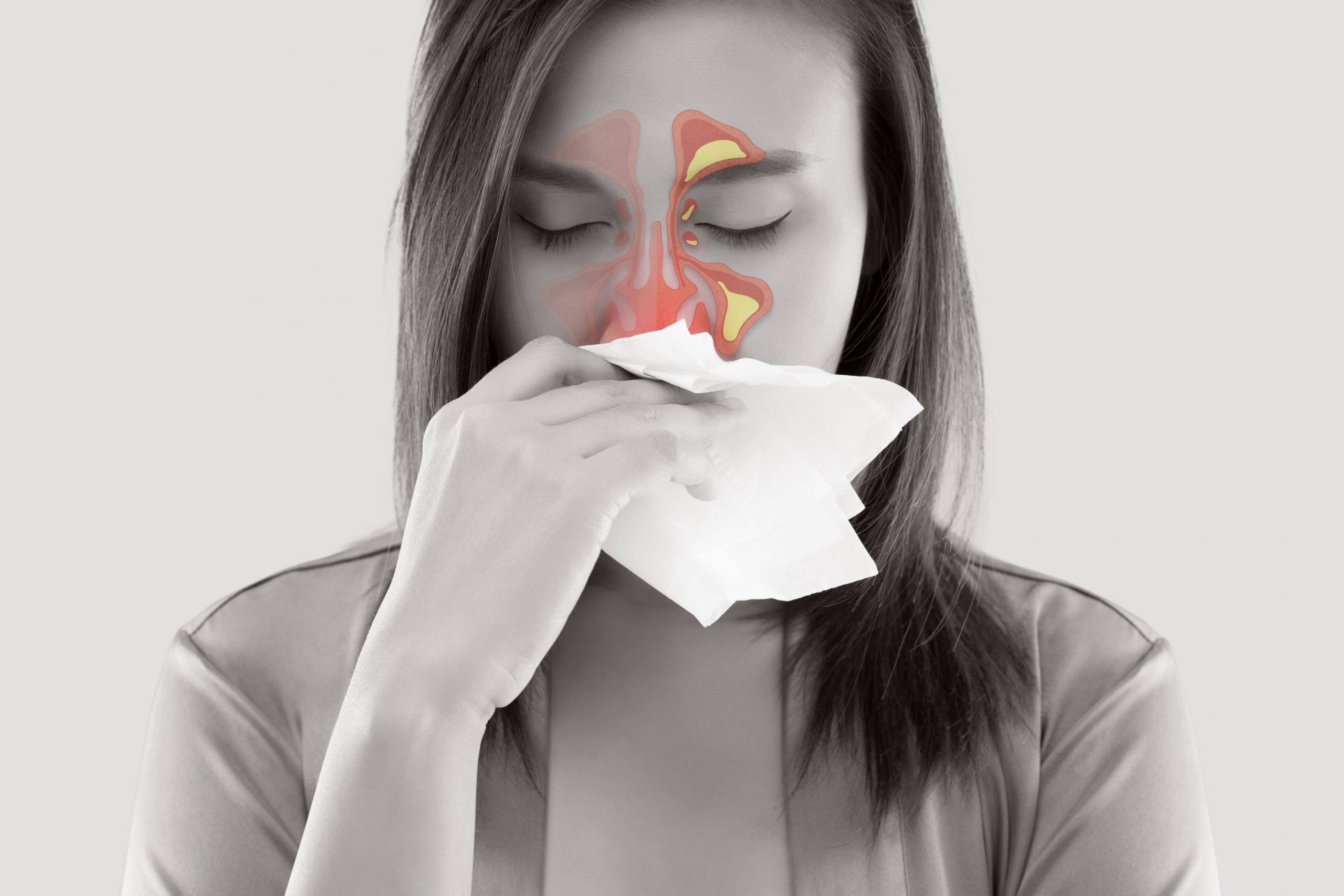 常流鼻血要当心,鼻腔也会长肿瘤